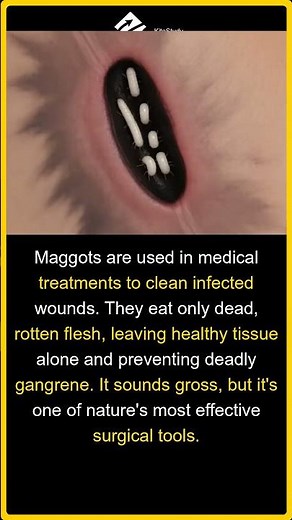 Healing Maggots | The Secret Doctors