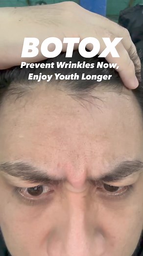 4.9K views | Why wait for wrinkles to appear? Start your Botox treatment today to prevent deeper lines from forming, allowing you to enjoy smoother skin for longer. It not only addresses existing lines but also helps prevent new ones from developing. Invest in your skin's future and let us keep your youthful glow. Send us a message to book an appointment. #botox #botoxfacial #botoxinjections #wrinkles | Savouge Aesthetics Pampanga | Facebook