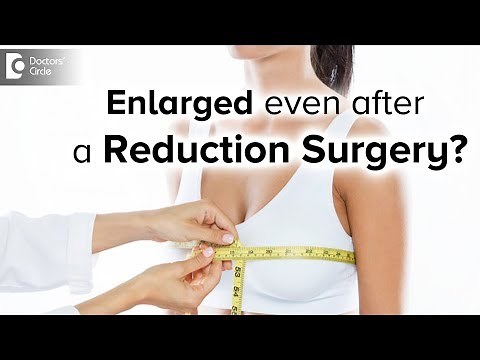 What to do for enlarged breasts after Breast Reduction Surgery? - Dr. Srikanth V | Doctors' Circle