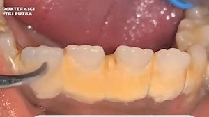 14K views · 108 reactions | art | The Dental Network | Facebook