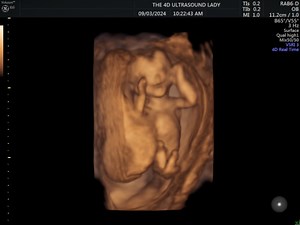 The tinniest baby yawn 🥰 #14weeks3daysOld | The 4D Ultrasound Lady
