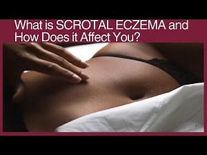 What is SCROTAL ECZEMA and How Does it Affect You?