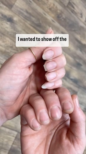 @manimaeve FYI: Wearing long nails will change the length of your nail beds! Your hyponychium (skin layer just under nail plate) will grow out past your finger tip as your nail system attempts to create a more stable anchor for your free edge to withstand stress 💅 You can see a huge difference in my nail beds; and this is from only about a year of wearing long nails on my left hand again (I went a year working at Starbucks which required no-product-on-nails so my nail beds retracted and have no