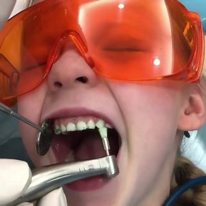 Sound up! #tickle #dentalcleaning  . . Credit: @dental.rocco | Dentistry blog | Facebook