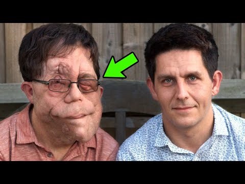 Meet The Identical Twins Who Look Nothing Like Each Other: Adam & Neil Pearson