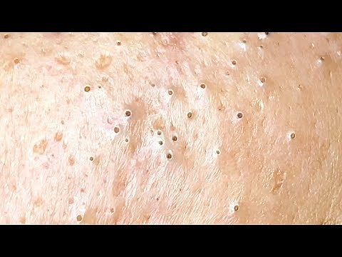 Relax Every Day With Sac Dep Spa #0077