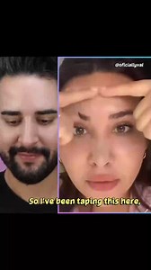 Face Taping To Prevent Wrinkles? #beauty #skincare #ageing | James Welsh