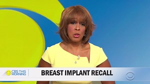Breast implant recipient on cancer diagnosis