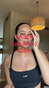Aerolase Laser for Acne: 1-Week Update and Q&A