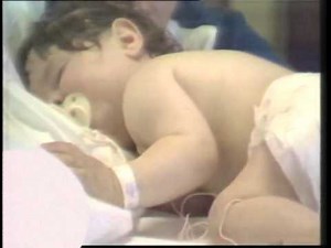 IMCI training video: Identifying stridor