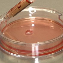 Video: Uso de células Caco-2 para estudiar el transporte de lípidos por el intestino