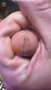 Is Starfish Really A Fish #shortsfeed #shorts #fishing #tranding #yt #viralvideo souravjvlogs | Uvk Shorts