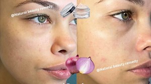 7.7K views · 56 reactions | Onion and cornstarch will Make you an 18-Year-Old Girl no matter Your Age #glowingskin #antiage | Natural Beauty Remedy | Facebook