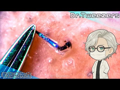 Observing the structure of a hair root.