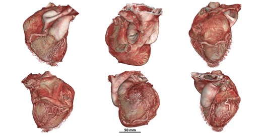 Cómo es el nuevo atlas digital interactivo que muestra los órganos humanos con ultra precisión