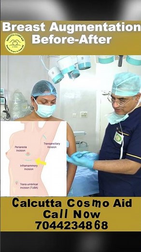 Breast Augmentation Before & After | Breast Implants Journey #Shorts