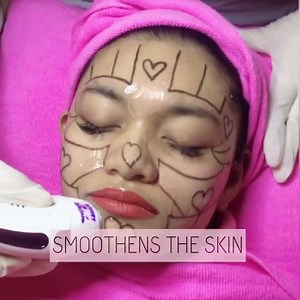 LAUNCHING NEW FACIAL✨ . HiFu Lift Treatment has many aesthetic benefits including: . ⚡️Wrinkle reduction ⚡️Tightening sagging skin on the neck ⚡️Lifting the cheeks, eyebrows and eyelids ⚡️Enhancing jawline definition ⚡️Tightening of the décolletage ⚡️Smoothing the skin . Contact us for booking, promotion details or any inquiries: 📲 013-8584889 https://wa.me/message/C3TR54PRENO2M1 📲 019-8928258 https://wa.me/message/PCVCME4LPIZ2K1 . #karlas #karlasmobilespa #spa #spakuching #kuching #kuchingsp