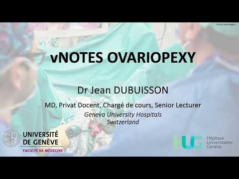 OVARIAN TORSION : vNOTES DETORSION AND OVARIOPEXY