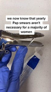1.9M views · 2.6K reactions | #pap#papsmear #smear #smeartest#midwifemama #midwife #periods #JuntosImparables | MidwifeMama | Facebook
