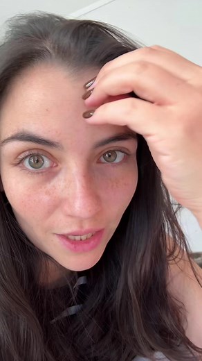 Alopecia: mi experiencia y tratamiento con pastillas, PRP y láser