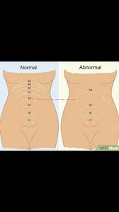 MEASURING OF FUNDAL HEIGHT DURING PREGNANCY . Fundal height is the distance, measured in centimeters, from a pregnant person's pubic bone to the top of their uterus, known as the fundus. Healthcare providers use this measurement, typically beginning around 20-24 weeks of pregnancy, to estimate fetal growth, check the gestational age of the baby, and ensure the pregnancy is progressing as expected. HOW IT'S MEASURED Position: The pregnant person lies on their back on an examination table. Measure