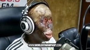 Man Goes On Radio Show And Recounts How An Electrical Wire Unexpectedly Cut-off From A Pole And Landed On Him!