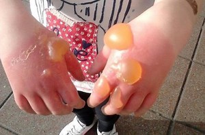 Meet giant hogweed, a horrifying invasive plant in Upstate NY that causes 3rd degree burns