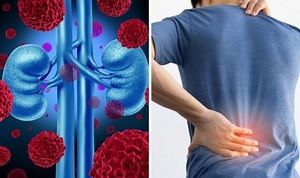 Kidneys: Expert details the signs something might be wrong