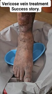 Nagaraj Angadi on Reels