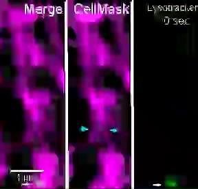 27 reactions | #QBI researchers have discovered how the highways connecting brain cells expand and retract to allow the flow of particles essential for neural survival. Credit: Dr Tong (Iris) Wang and Professor Fred Meunier. Discover more: bit.ly/3daVYzF | Queensland Brain Institute | Facebook