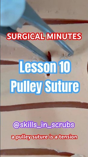SURGICAL MINUTES |Lesson 10 | Pulley Suture | Dr. Atharva kolekar