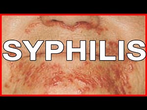 What Causes Syphilis? Symptoms and Signs, Treatment and Health Risks