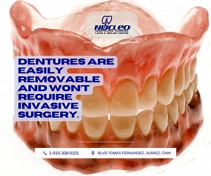🦷 Dentures: A Smart Choice for a Complete Smile! 😁 Why choose dentures? Here are the top advantages: ✅ Restores your smile & facial structure ✅ Improves chewing & speech ✅ Affordable & non-invasive solution ✅ Custom-made for a natural look & comfort ✅ Easy to clean & maintain Regain your confidence with a beautiful, functional smile! ✨ #Dentures #SmileWithConfidence #ToothReplacement . 📱🦷 915 308 0101 nucleodental.com . #NucleoDental #dentalclinicnearme #dentaltourismmexico #dentalimplantsju