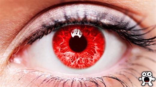The rarest human eye colors.