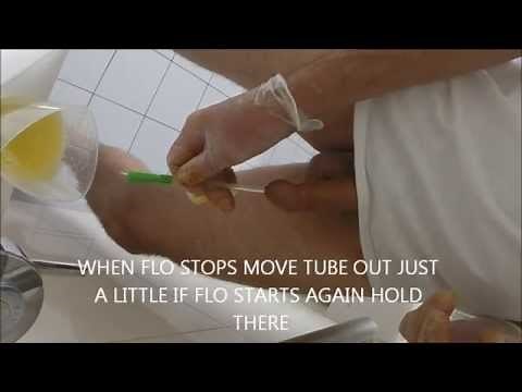 SELF CATHETERIZATION