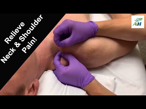 Dry Needling for Neck and Shoulder Tightness and Pain