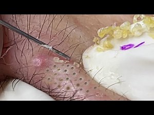 Satisfying With Loan Nguyen Spa Video #003