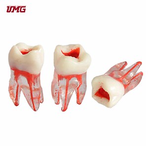 [Hot Item] Teeth Model for Studying Tooth Model Root Pulp Cavity Model