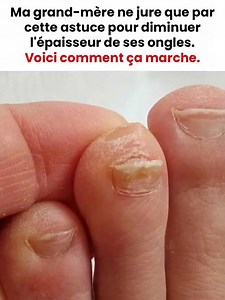 97K views · 179 reactions | Et ça ne prend qu'une minute par ongle... Voir le 1er commentaire | Aimer Tant que Possible | Facebook