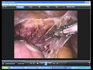 Surgical Anatomy of the Female Pelvis • Video • MEDtube.net