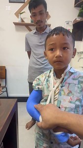 93K views · 3K reactions | Supracondylar fracture (Type-II) ছোট্ট...