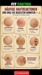 👀 Deine Haut verrät mehr über deine Gesundheit, als viele denken! #fitfakten