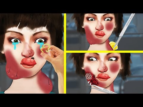 💟 ASMR ☮️ Wasp STING Swollen Lip SATISFYING Surgery Treatment Animation