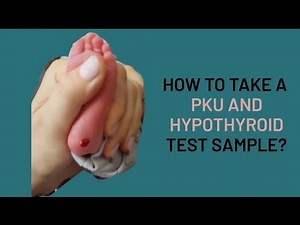 HOW TO TAKE PKU TEST SIMPLE? | NURSESCOPE