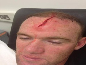 Wayne Rooney publishes shocking pictures of his injury at the head on Facebook - Africa Top Sports
