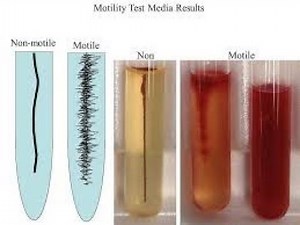 Motility Agar (Bacteria Motility Test) ; Definition, Composition, Microbiology, Preparation, Uses