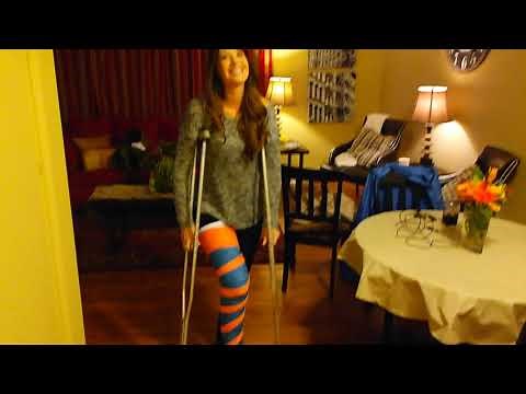 Jane's first time on her crutches! Long leg cast!