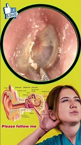 ear wax removal drops -ep03