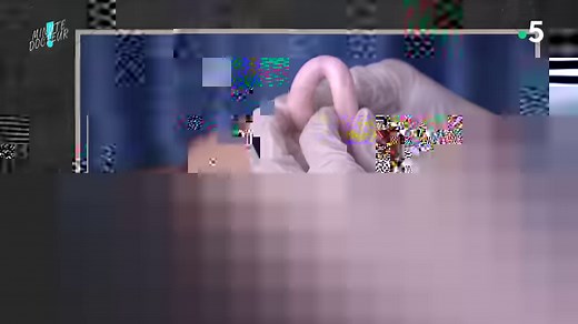 🤔 L’une des solutions utilisées pour retenir les organes du bas ventre en cas de prolapsus (ou descente d'organe) est le PESSAIRE, un anneau souple... Mais il n’a pas toujours ressemblé à ceux utilisés aujourd’hui ! 🔎 ON VOUS EXPLIQUE ! ⤵️ | Allo Docteurs - Le Mag de la Santé