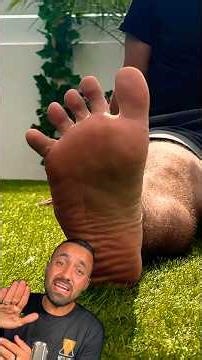 How to Fix Your Toe Splay